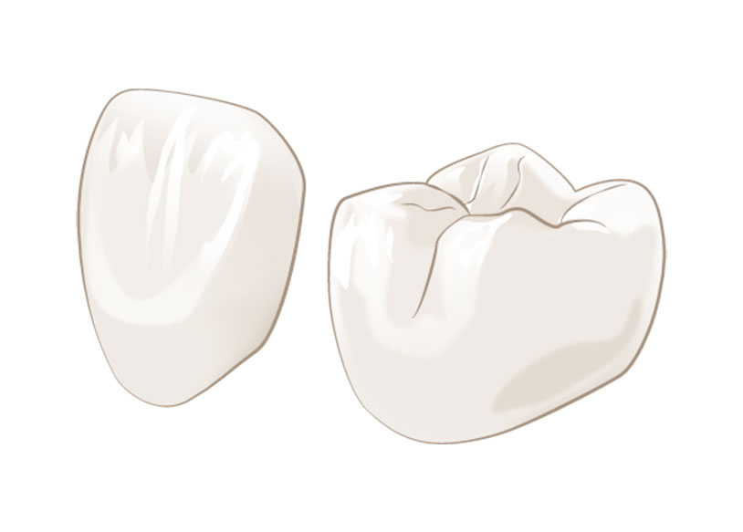 しのはら歯科医院　審美治療　ジルコニア