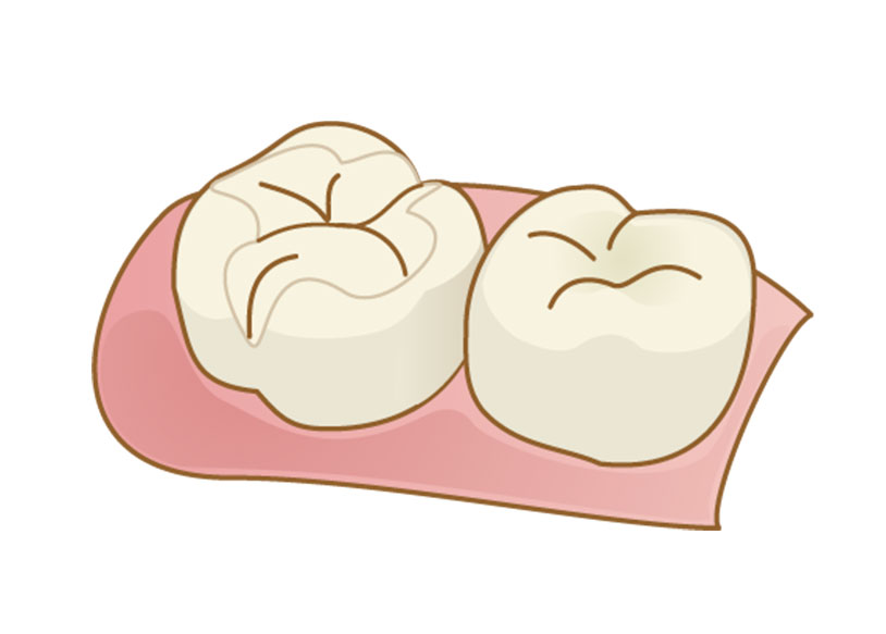 しのはら歯科医院　一般歯科　つめる治療