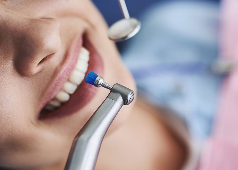 しのはら歯科医院　PMTC