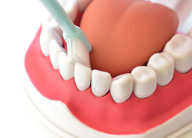 しのはら歯科医院　PMTC　バイオフィルムの除去