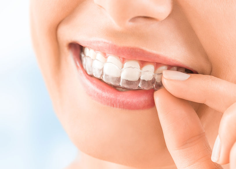 しのはら歯科医院　インビザライン