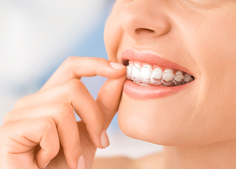 しのはら歯科医院　インビザライン