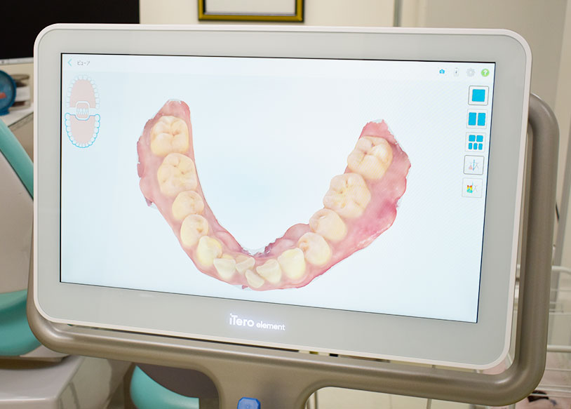 しのはら歯科医院　iTero